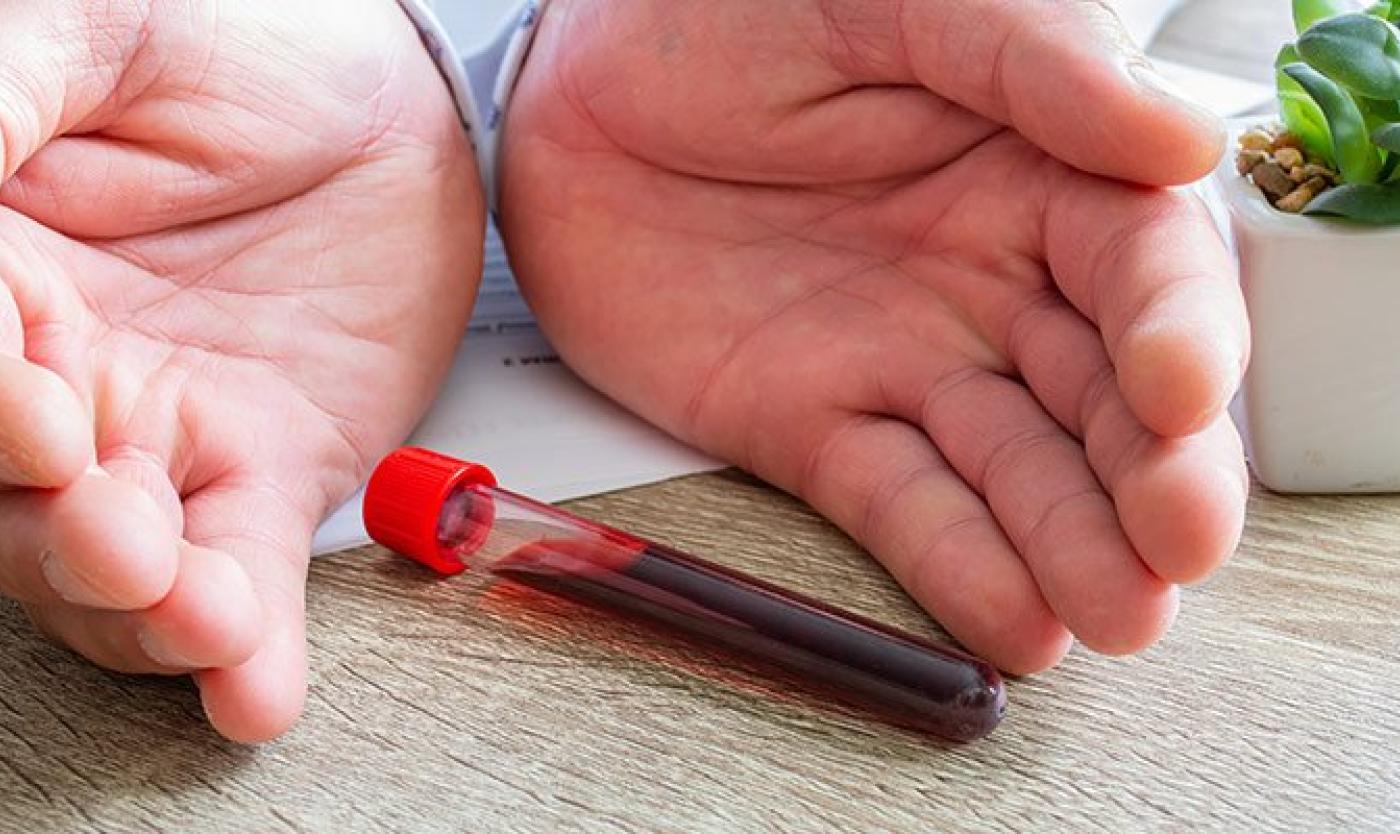 particularites-hemophilie-b-bijzonderheden-hemofilie-b940x400-d3952d9f.jpg