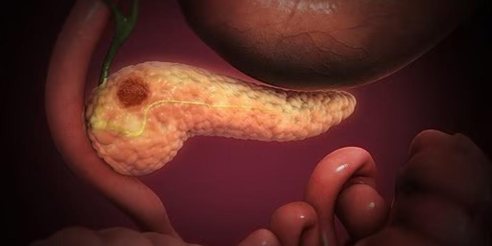 2024_PANCREASKANKER_SCIENITIFIC_ANIMATIONS_INC. 2024_PANCREASKANKER_SCIENITIFIC_ANIMATIONS_INC
