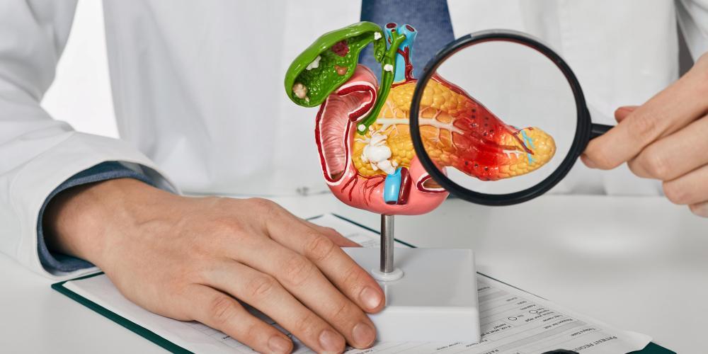 20251021_DiagnosePancreaskanker_Shutterstock.jpg