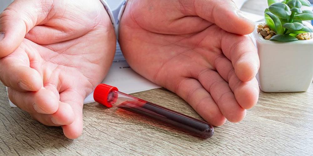 particularites-hemophilie-b-bijzonderheden-hemofilie-b940x400-d3952d9f.jpg